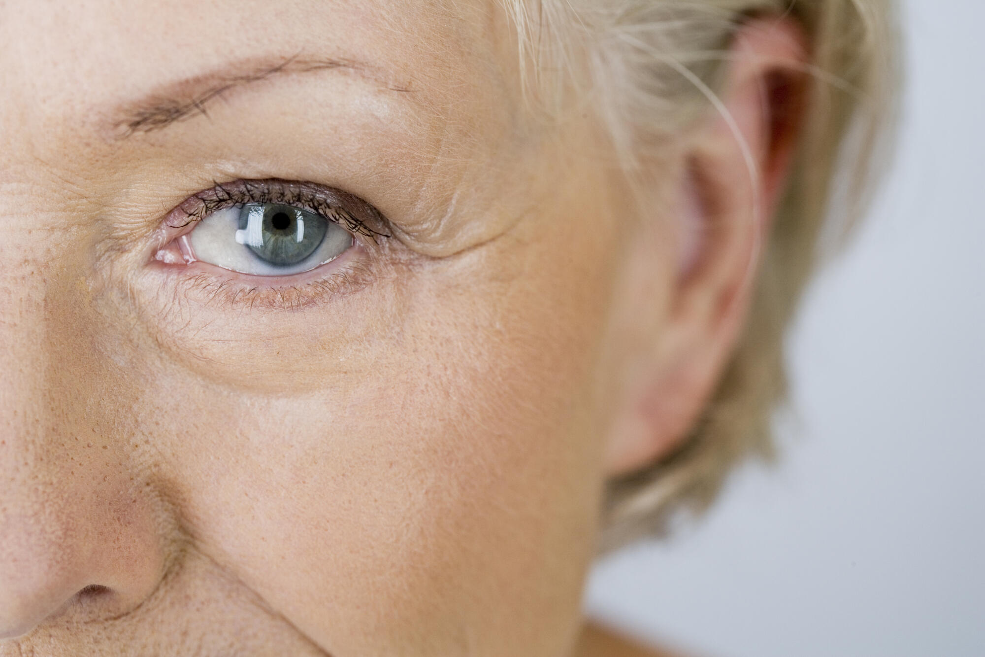 Hypertensive Retinopathy in Seniors: What to Know About Eye Health